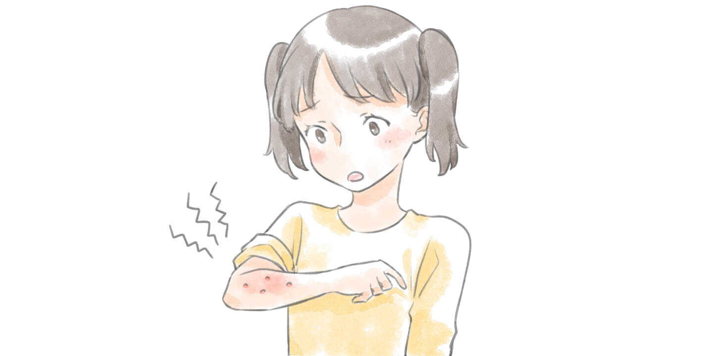 皮膚障害 皮膚障害