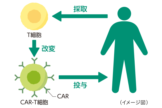 T細胞を改変したCAR-T細胞を投与するCAR-T療法 T細胞を改変したCAR-T細胞を投与するCAR-T療法