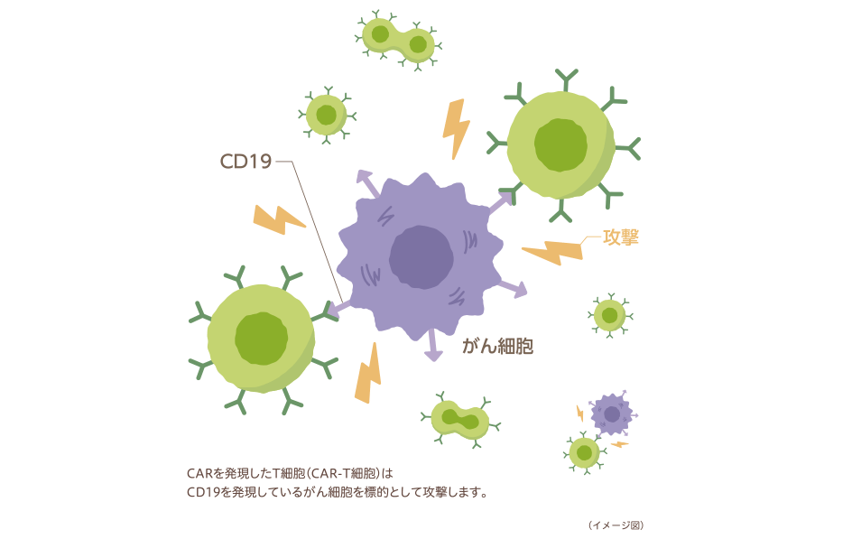 CD19を発現しているがん細胞を攻撃するCAR-T細胞