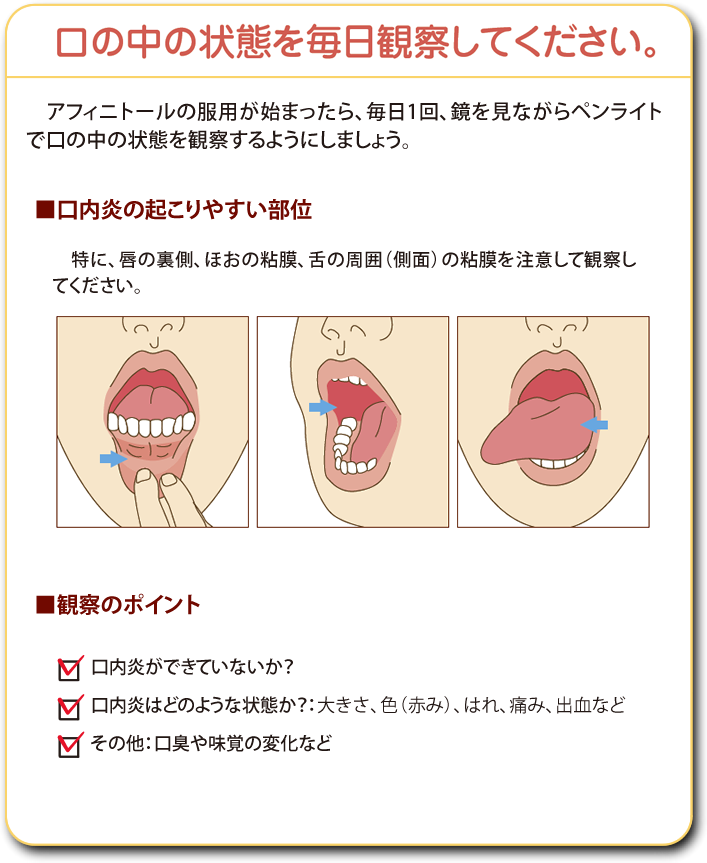 口の中の状態を毎日観察してください。