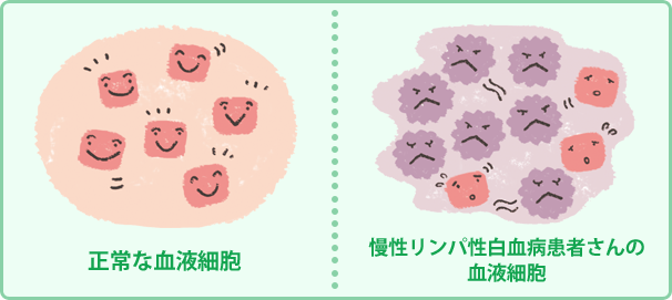 正常な血液細胞 慢性リンパ性白血病患者さんの血液細胞