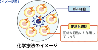 化学療法のイメージ