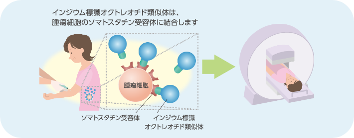 インジウム標識オクトレオチド類似体は、腫瘍細胞のソマトスタチン受容体に結合します