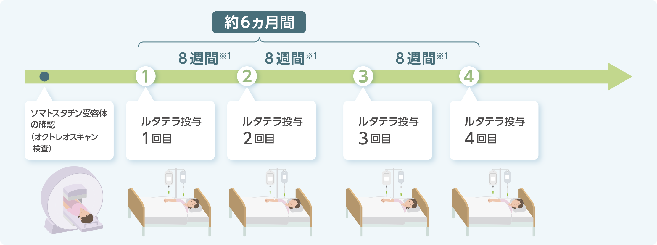 イメージ:ルタテラ®静注の治療スケジュール