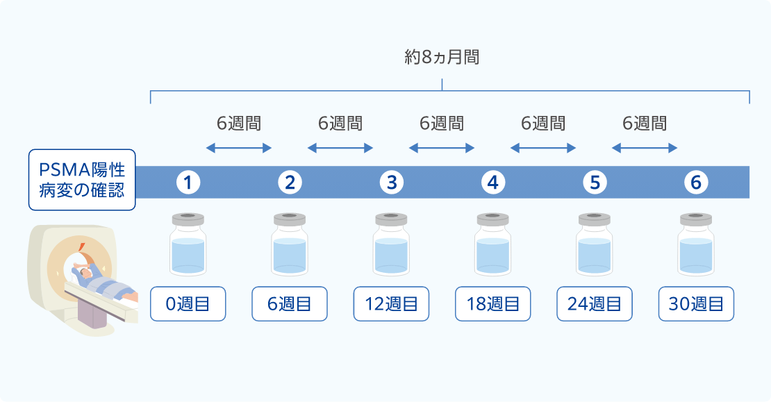 イメージ図：治療全体のスケジュール