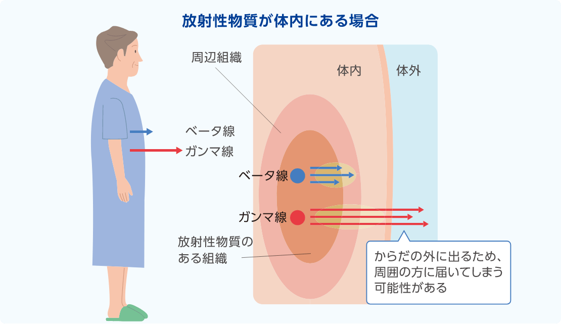 イメージ図：放射性物質が体内にある場合