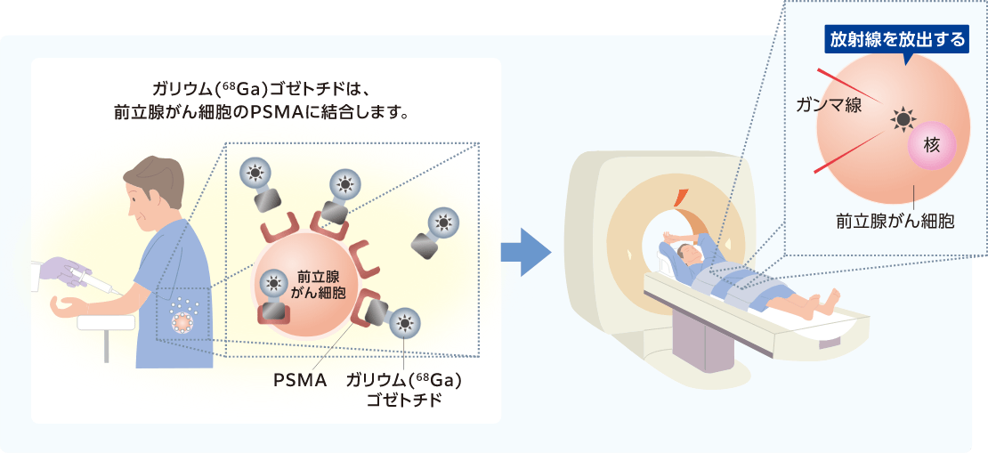 イメージ図：PSMA-PET検査の仕組み