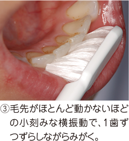 ③毛先はほとんど動かないほどの子機座に名横振動で、1歯ずつずらしながらみがく。