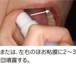 または、左右のほお粘膜に2～3回噴霧する。