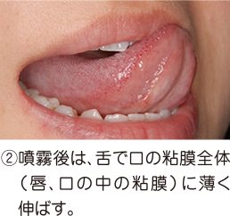 噴霧後は、舌で口の粘膜全体（唇、口の中の粘膜）に薄く伸ばす。