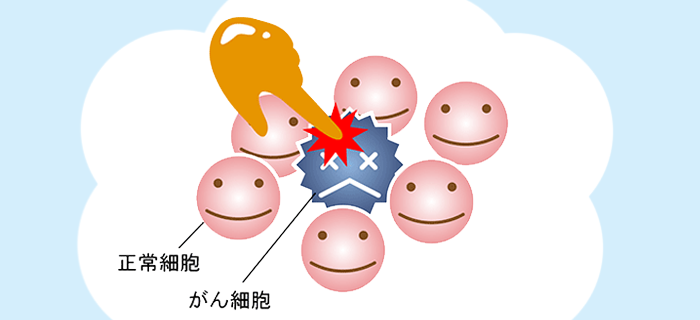グリベック®を服用されるGIST（消化管間質腫瘍）患者さんへ