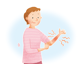 皮膚の発疹症状イメージ