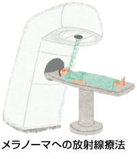 メラノーマへの放射線療法イメージ